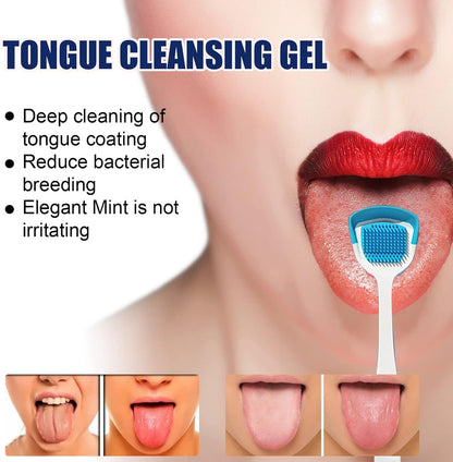 Gel i četkica za čišćenje jezika OralFresh
