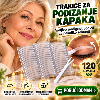 Trakice za podizanje kapaka - 120 komada