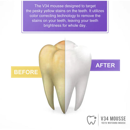 SmileKit – Pasta za Izbjeljivanje Zuba sa V34 Tehnologijom