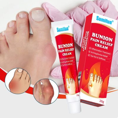 Krema za neutralisanje bolova i upaljenosti čukljeva (1+1 GRATIS)